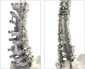 Vergleich der anatomischen Modelle