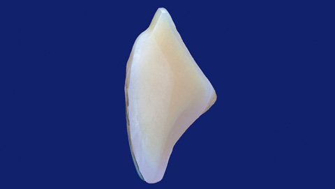 2008 Einführung der Quint-Zähne