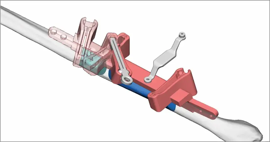 VSP - Virtuelle Operationsplanung