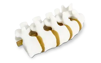 Anatomisches Wirbelsäulenmodell in 3D-Druck von 3D Systems