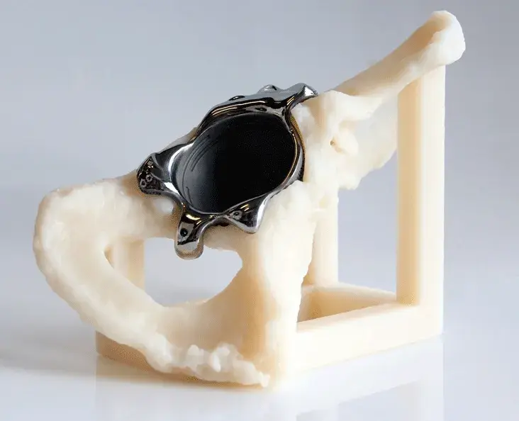 3D Systems Gesundheitswesen SLA Knochenmodell mit DMP-gefertigtem Dreiflansch aus Titan