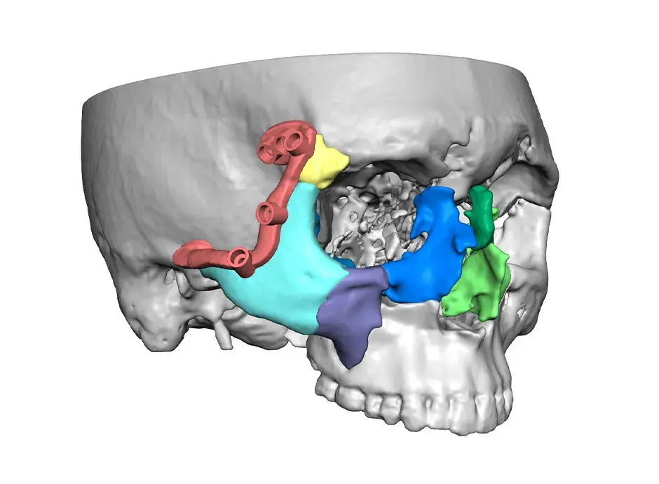 a skull rendering for VSP Distraction