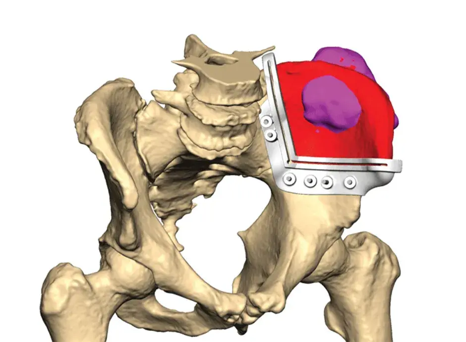 Orthopaedics Pelvic Zoom