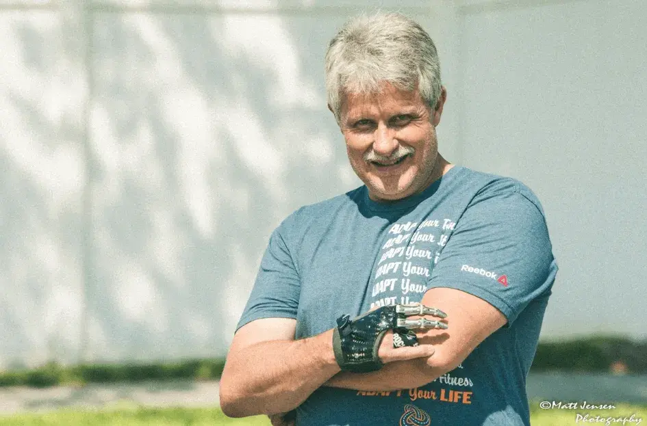 Jeff Soelberg trägt seine Teilhandprothese von Point Designs