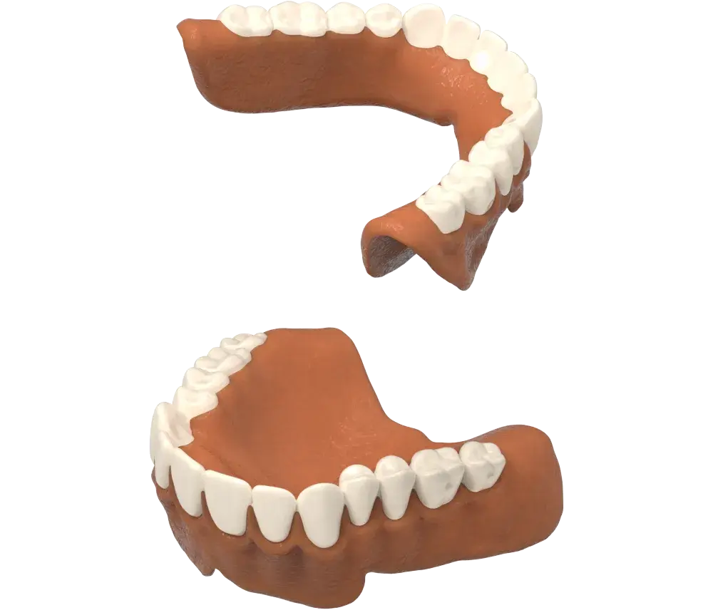 NextDent Produktionswachs wurde entfernt