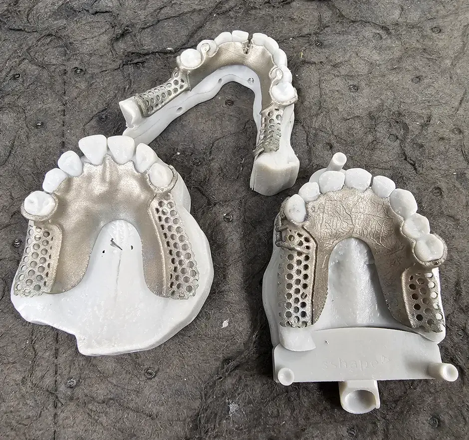 3D-gedruckte Dentalteile