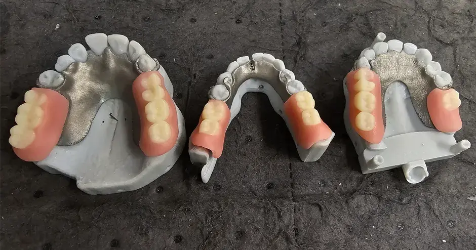 3D printed dentures from GPS